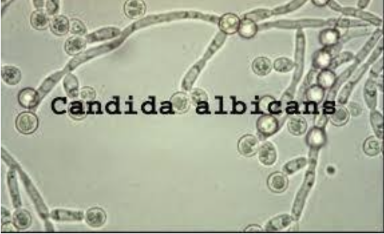 Candida albicans